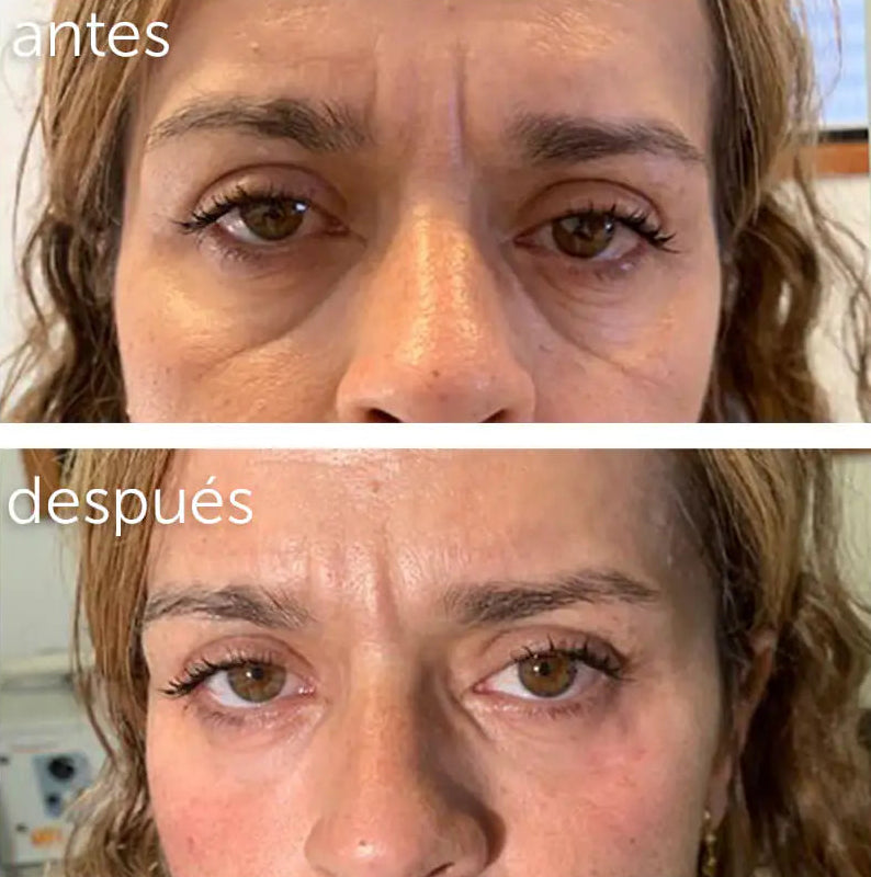 Acido Hialuronico 2% B5 The Ordinary 30ml